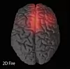 thumbnail: brain.png